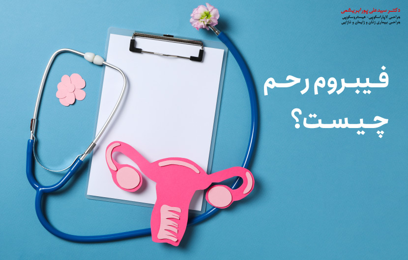 فیبروم رحم